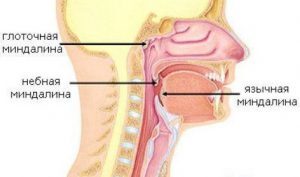 yazychnaya-mindalin-300x177-6024966